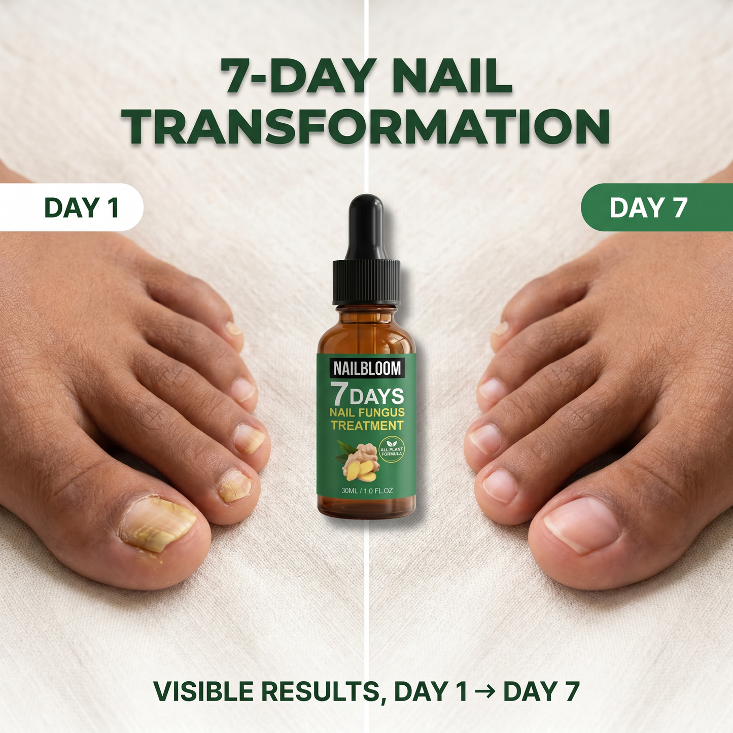 Nailbloom™ 7 Days Nail Fungus Treatment | Plant Based Drops | Buy 1 Get 1 FREE